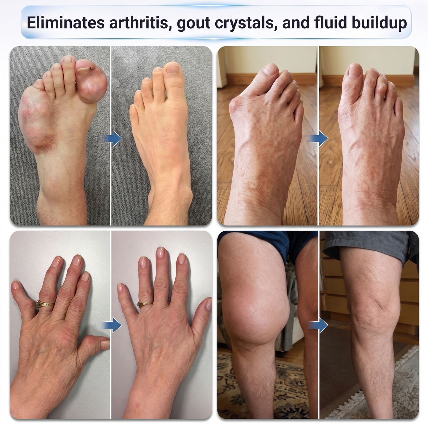 𝐼𝙁𝐌𝑨𝐆𝙄𝐂® ✅ 𝟬.𝟬𝟱𝗺𝗺 𝐌𝐢𝐜𝐫𝗼𝗻𝗲𝗲𝙙𝙡𝙚 𝑩𝒐𝒏𝒆 & 𝐉𝐨𝗶𝗻𝘁 𝗥𝗼𝗹𝗹𝒆𝙧🦵