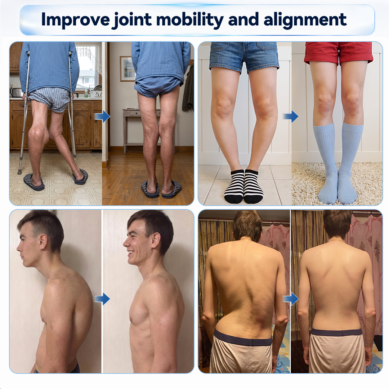 𝐼𝙁𝐌𝑨𝐆𝙄𝐂® ✅ 𝟬.𝟬𝟱𝗺𝗺 𝐌𝐢𝐜𝐫𝗼𝗻𝗲𝗲𝙙𝙡𝙚 𝑩𝒐𝒏𝒆 & 𝐉𝐨𝗶𝗻𝘁 𝗥𝗼𝗹𝗹𝒆𝙧🦵